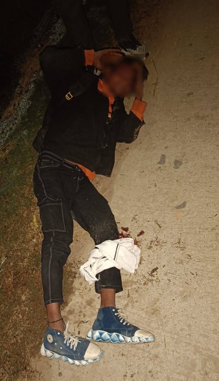 Criminal shot in leg in police encounter, arrested