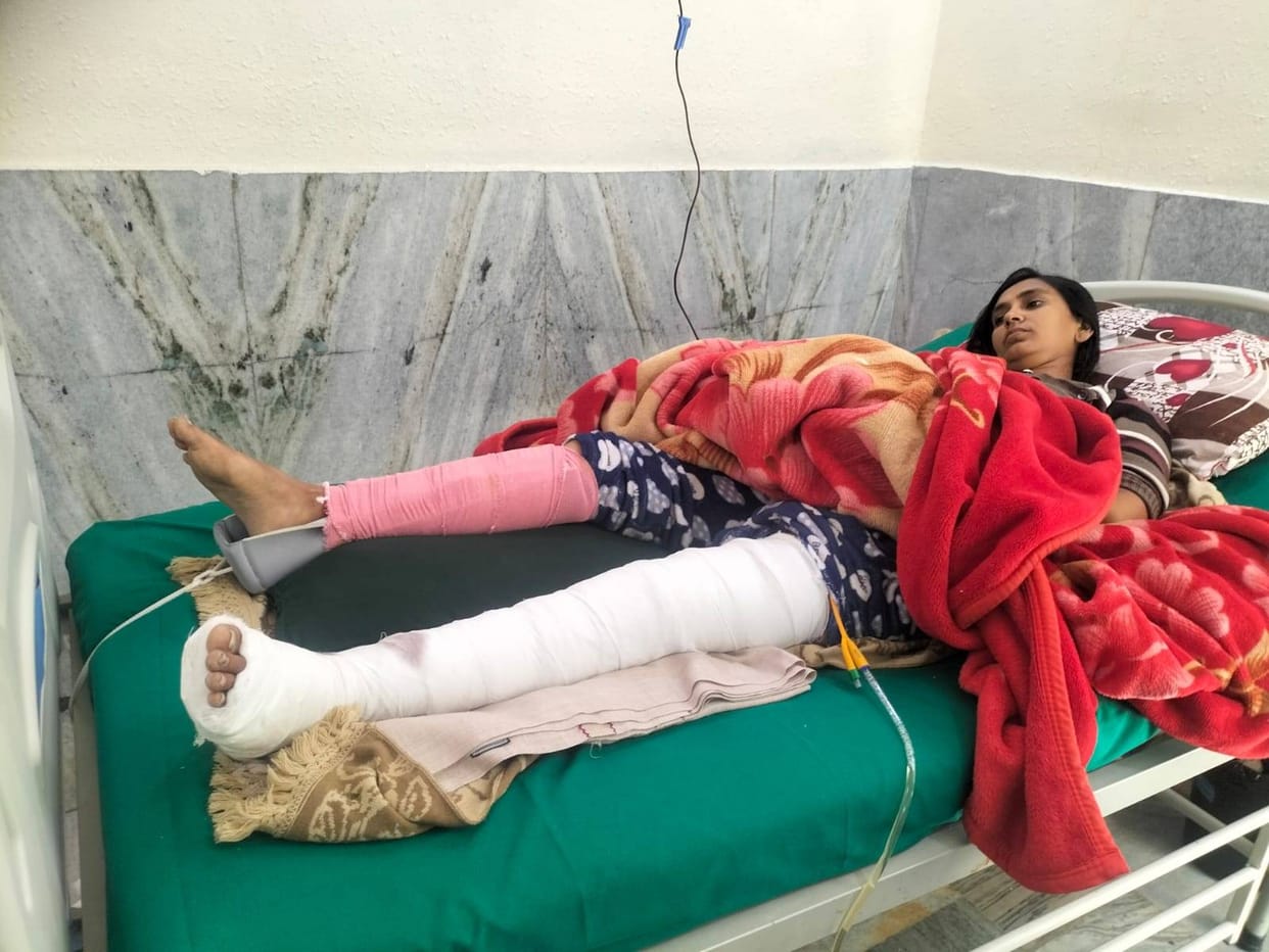 A group of monkeys attacked, a woman jumped from the roof to save her life, both legs were broken