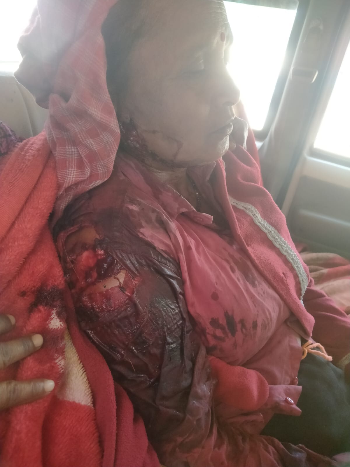 Tiger attacks woman cutting grass, injured