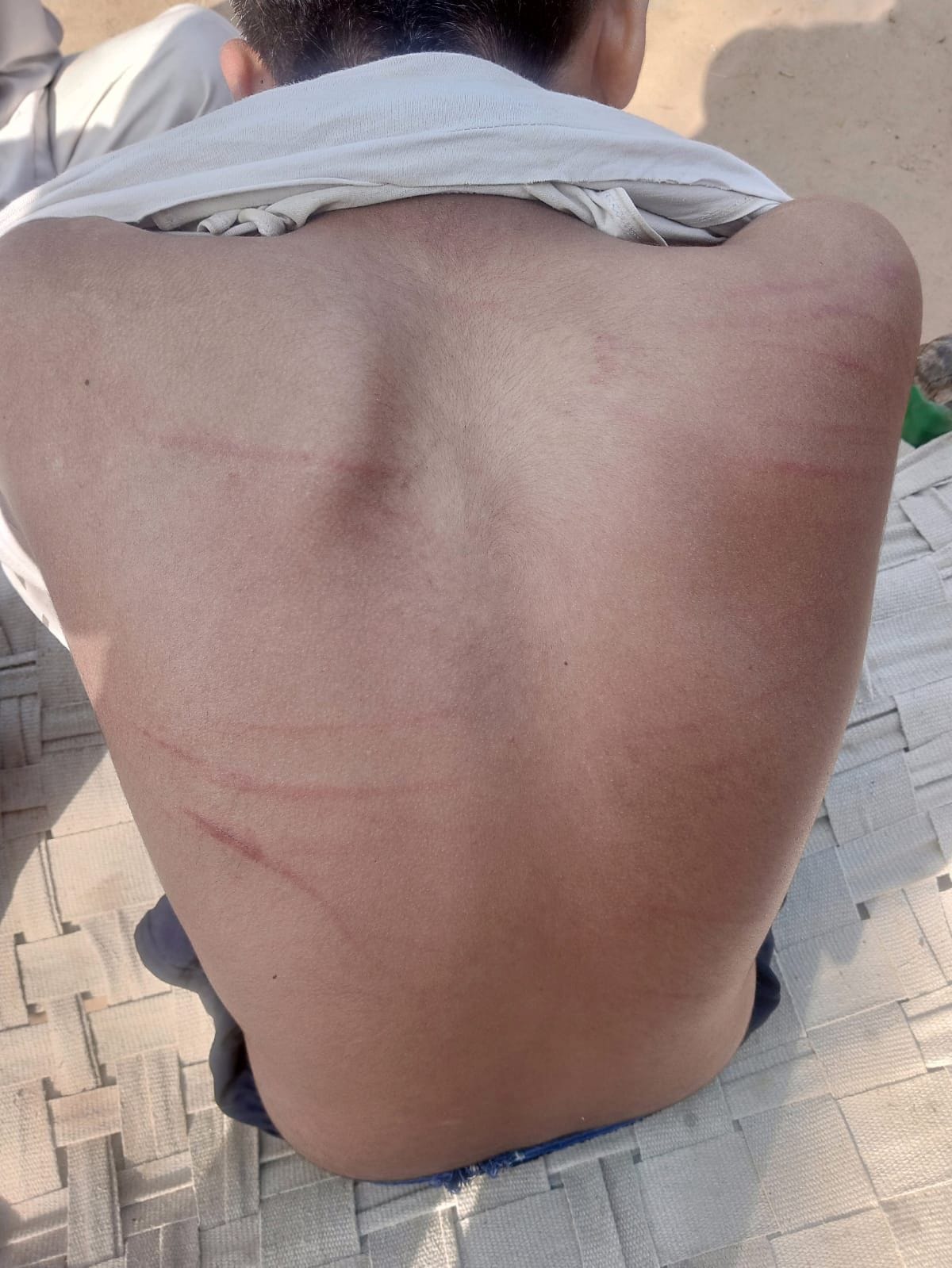 Accused of brutally beating two students in Devrala school