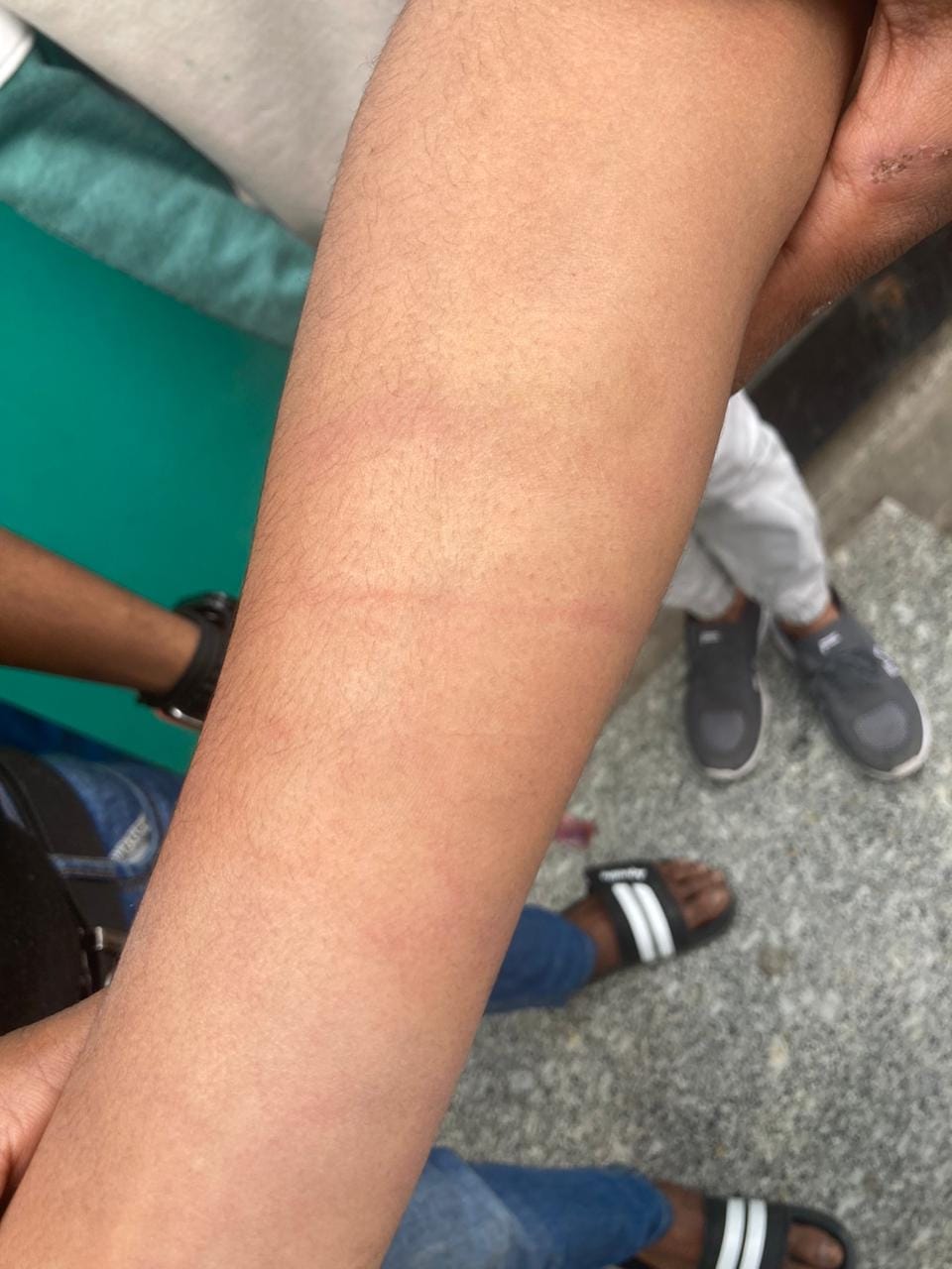 Chairman beats 9th class student living in hostel with sticks