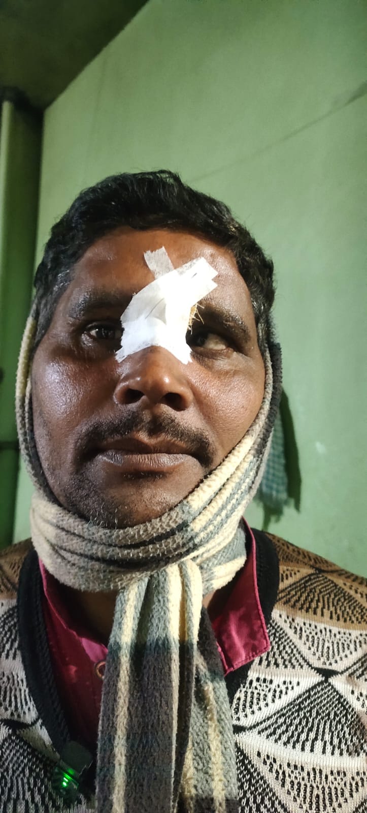 Priest injured by Chinese door, case registered against a shopkeeper