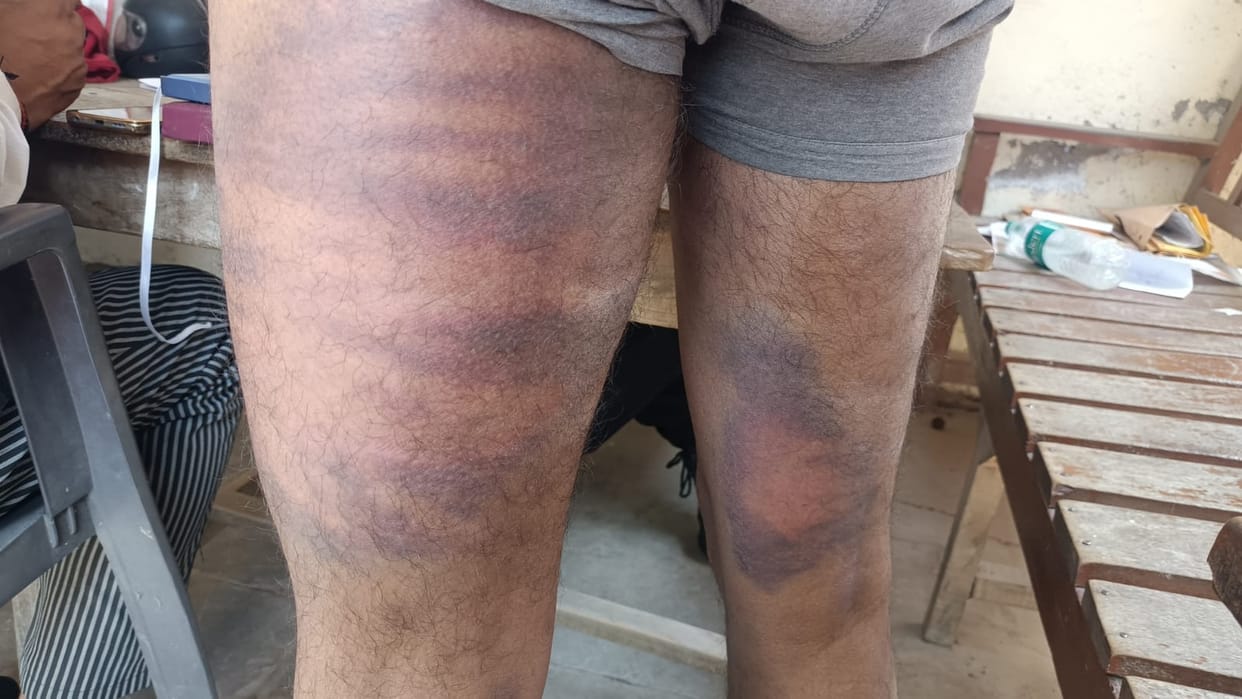 The person who beat the electrician arrested