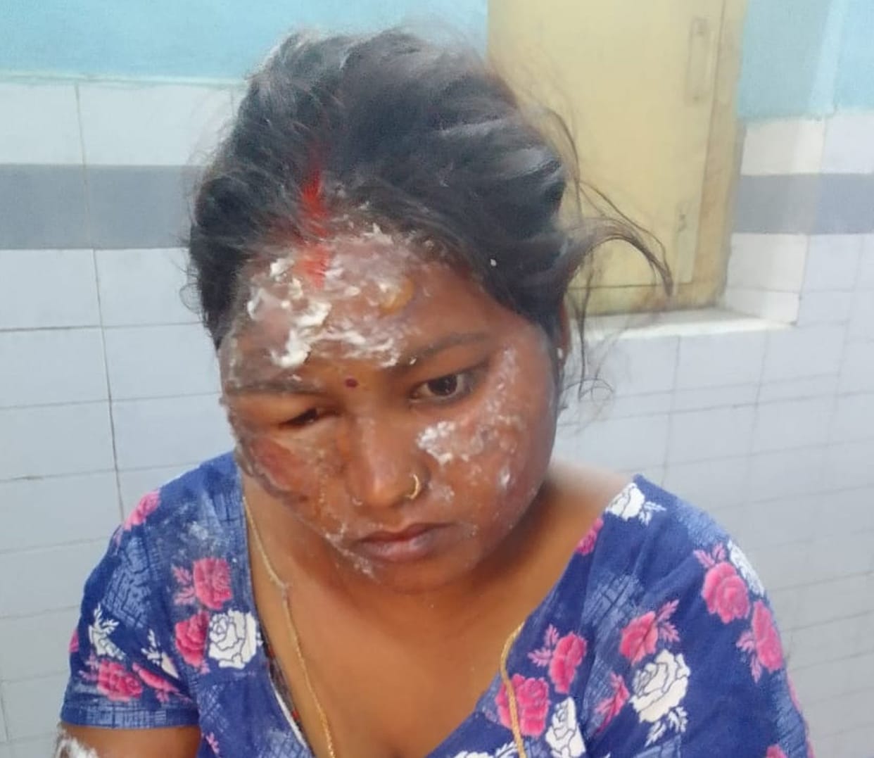 Four houses burnt down in fire, two women burnt