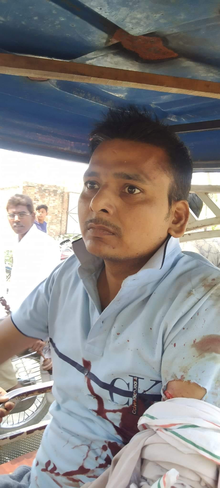 Three injured in tiger attack... Angry crowd chased the tiger into the fields