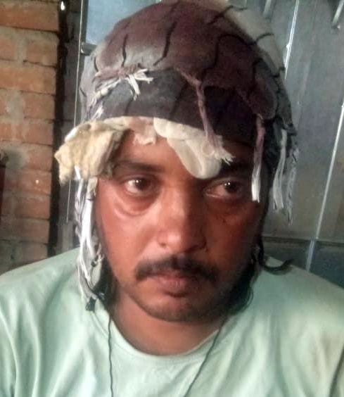 Neighboring family beaten up due to rivalry, case against 10 including six named