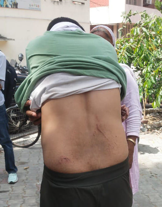 Fight between medical college security personnel-attendants, people from both sides including doctor injured