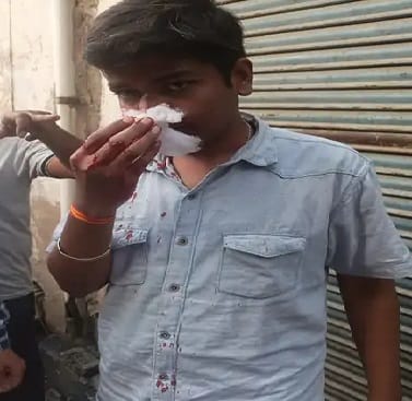 Young man beaten up in collision between vehicles, case registered