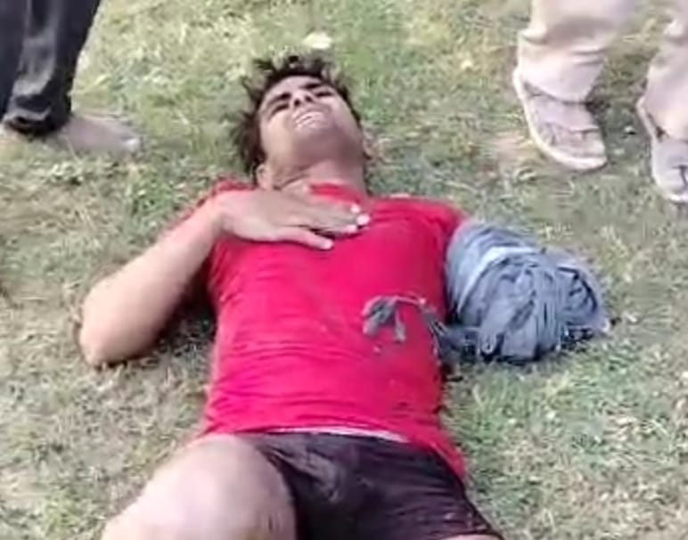 Crocodile attacks young man, one hand severed from torso