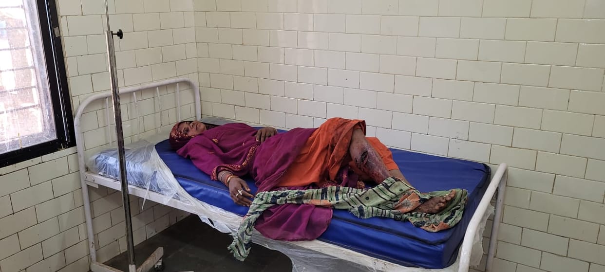 Damoh's Bhurkheda village, husband tried to cut off wife's leg with an ax over a minor dispute