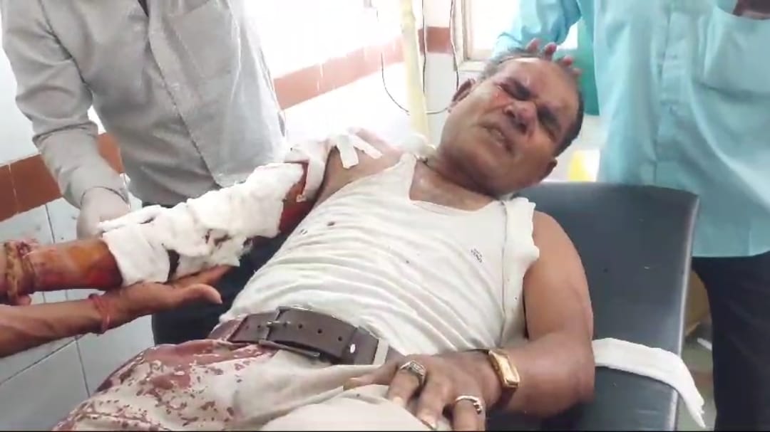 Accident, Khargone News Nayab Tehsildar Injured In A Road Accident