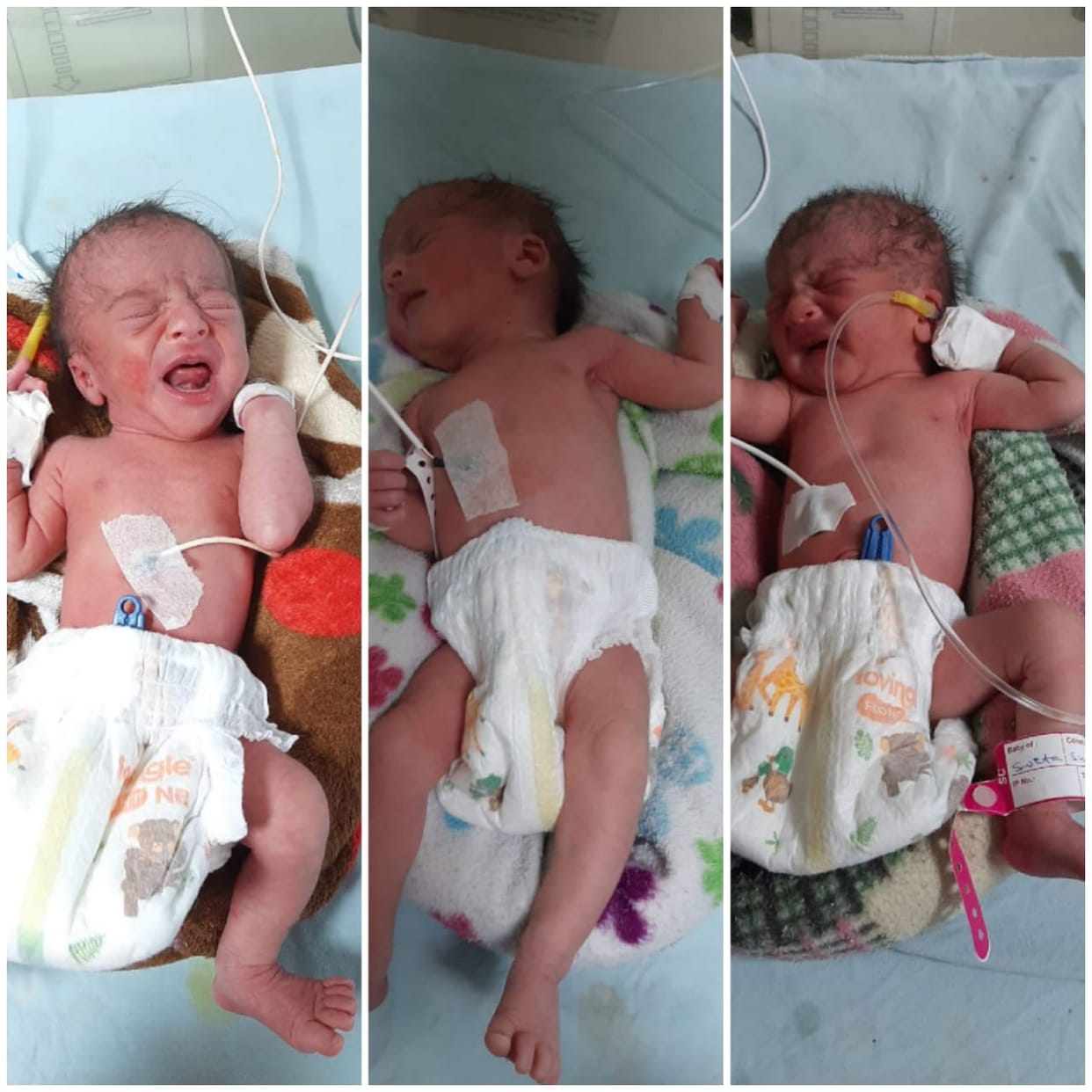 Woman gives birth to three daughters after eight years of marriage in Damoh