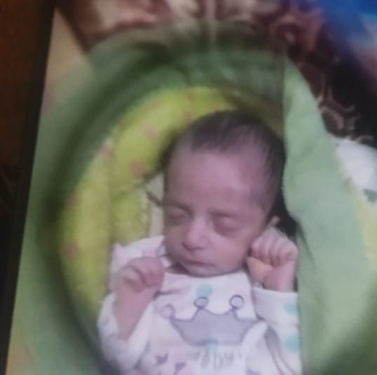 Newborn leg fractured, died after 10 days