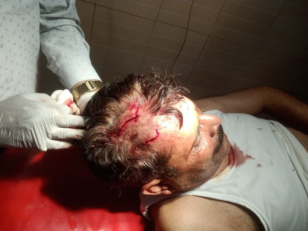 Guldar's attack on forest ranger who was setting trap