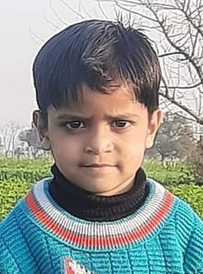 Six year old boy falls into frying pan, dies during treatment