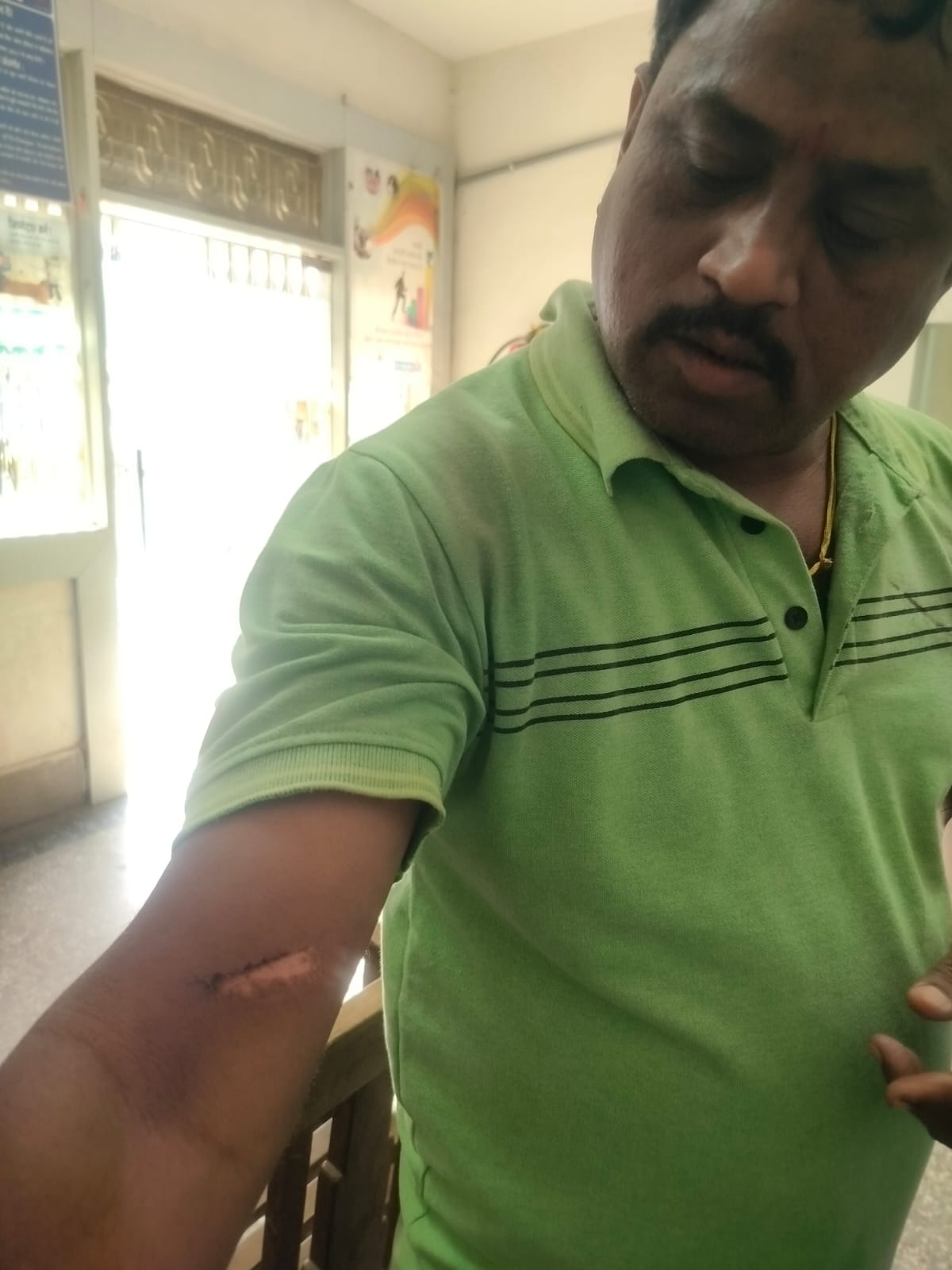 Electric wire fell on a bike rider on Damoh Jabalpur road