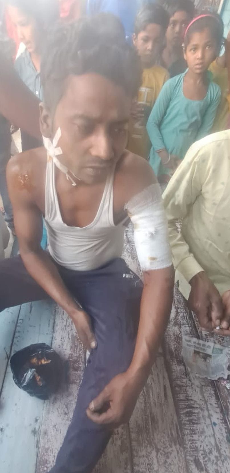 Leopard attack, farmer saved his life by struggling, condition critical