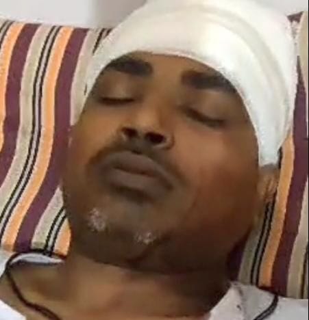 Youth's head broken for making video of soil mining with JCB
