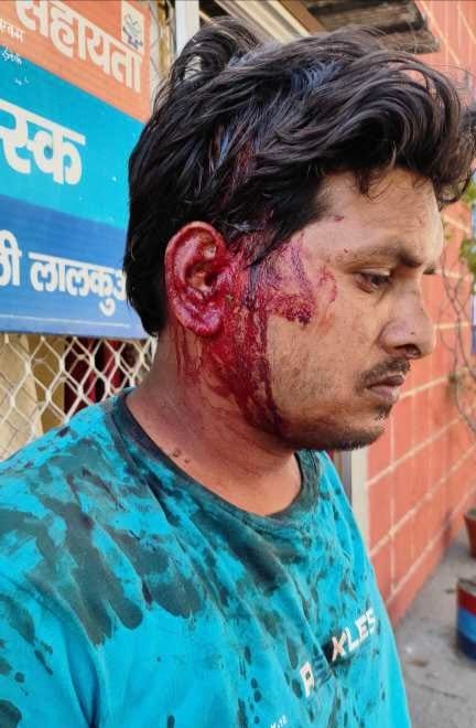 Tuktuk riders attack dumper driver
