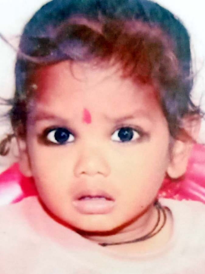Took medicine to cure pimples from medical store, died after health deteriorated