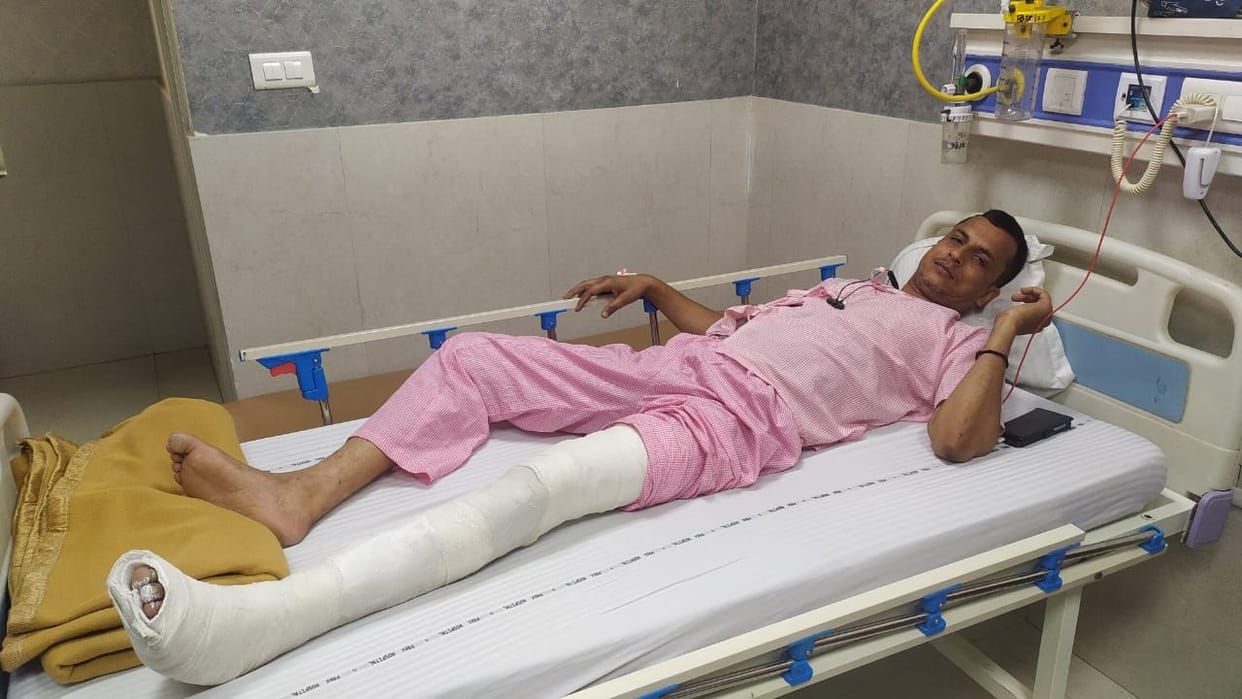 While extinguishing the fire, another tank also exploded, worker's leg broken at two places