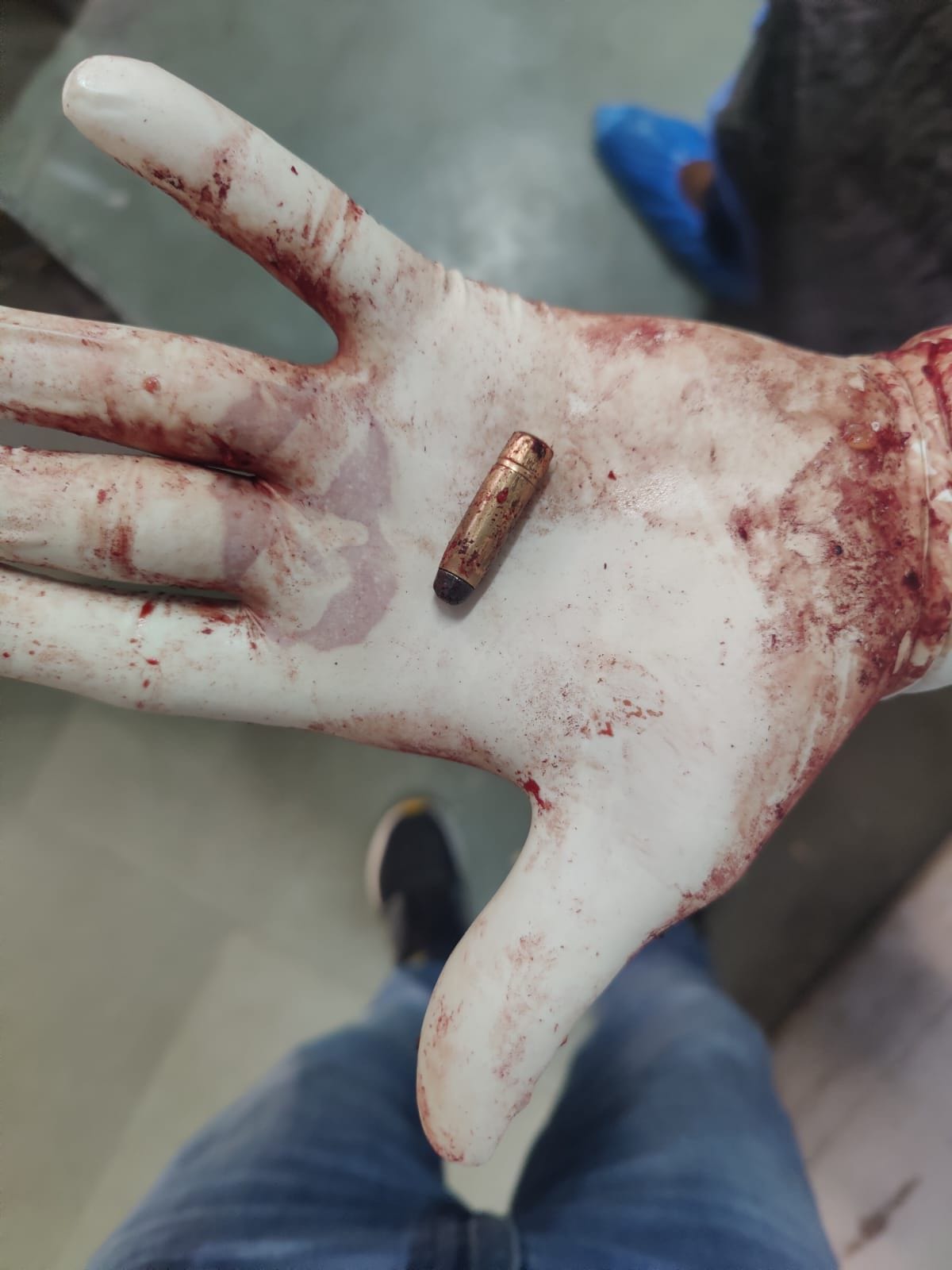After two and a half hours of struggle, the bullet was removed from Abhimanyu's chest, four police teams engaged in search of the murderers.