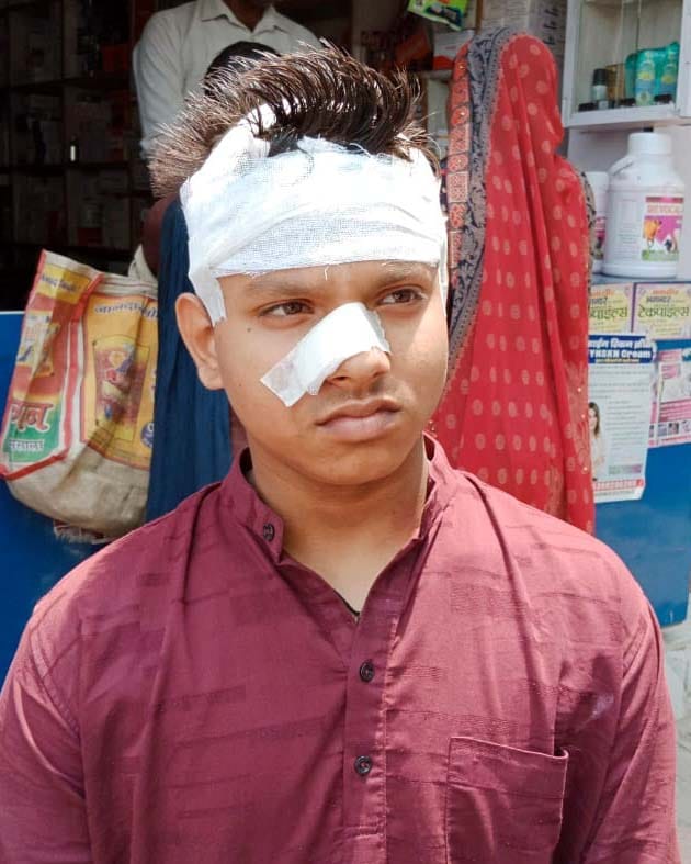 Fight between BDV students, one injured