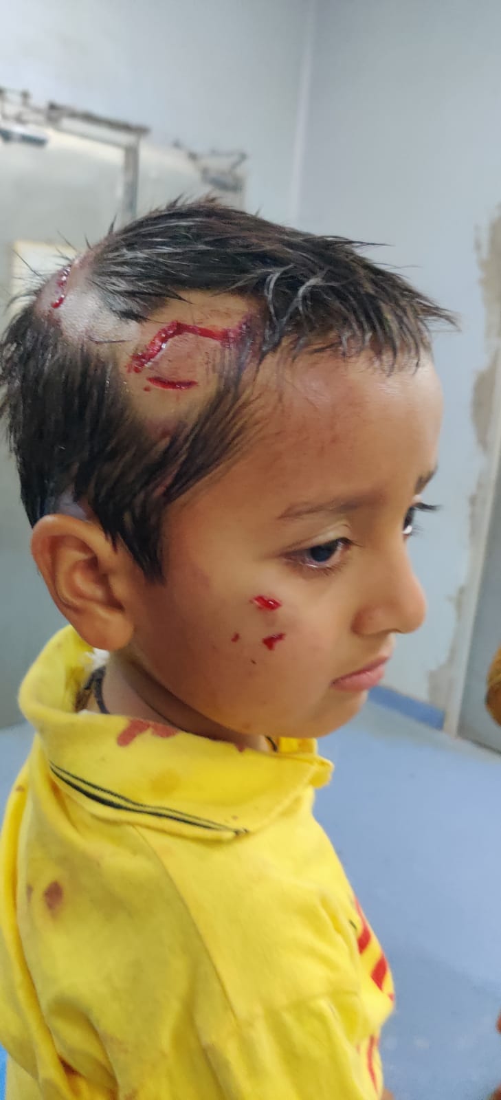 dog bite boy in jamta