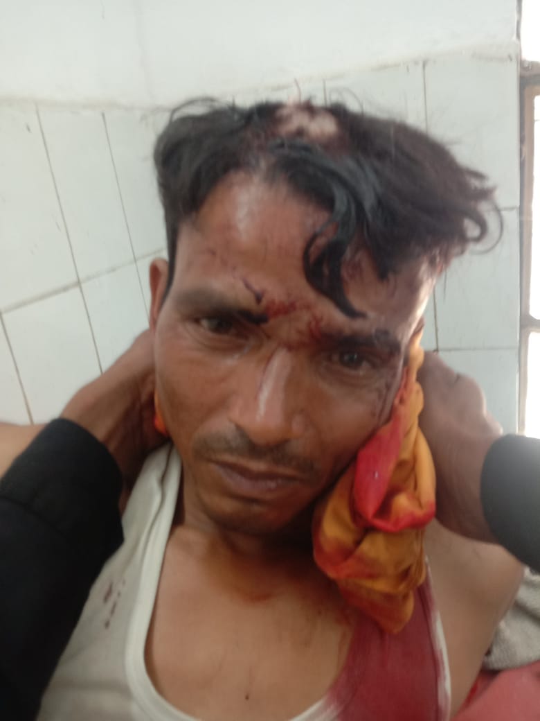 A laborer going to collect wood was attacked by a leopard and left bleeding.