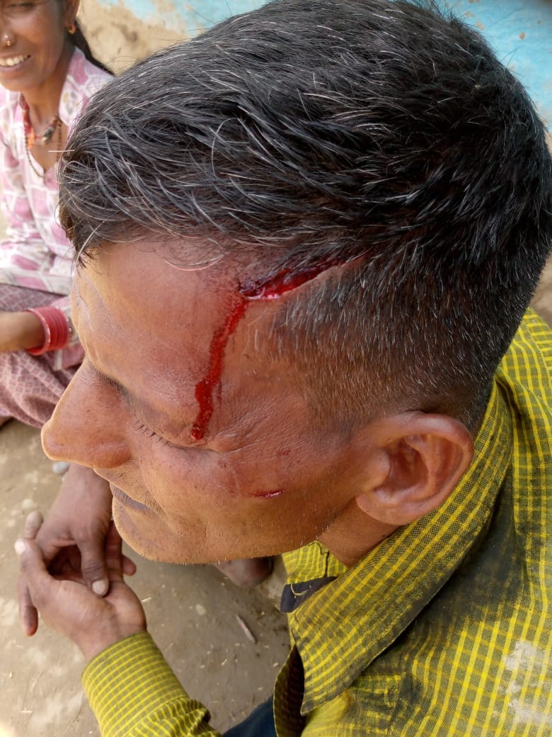 Leopard attacked villager