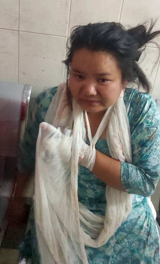 Took hand out of vehicle, lost finger