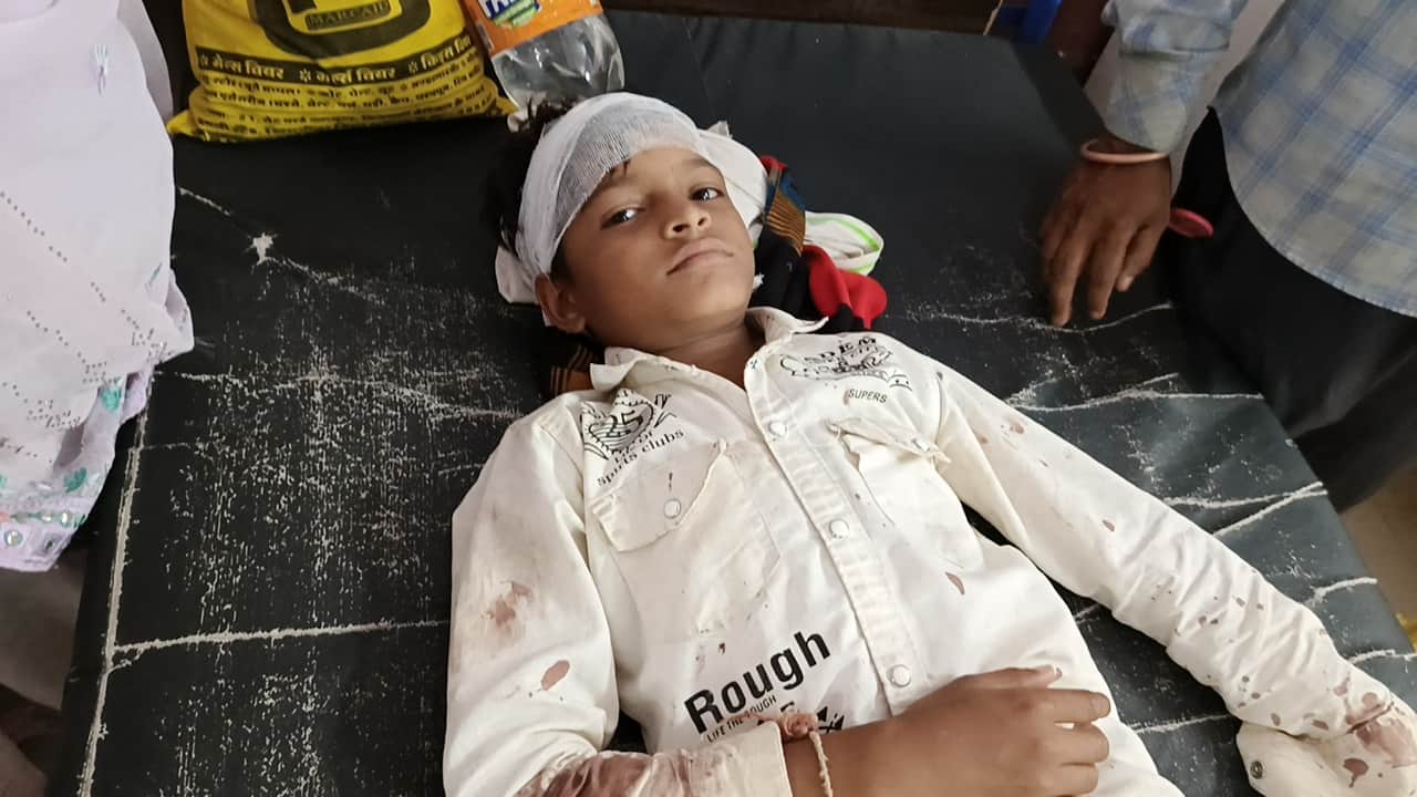 अस्पताल में भर्ती पीड़ित बालक