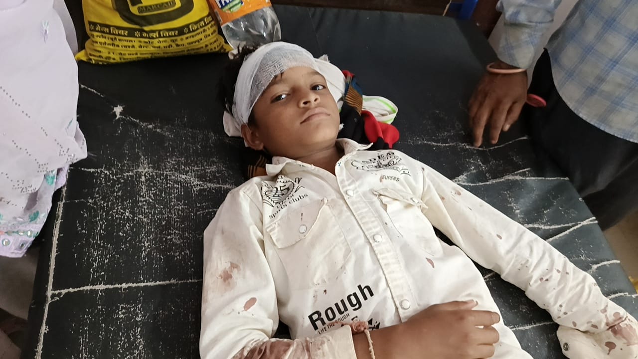 अस्पताल में भर्ती पीड़ित बालक