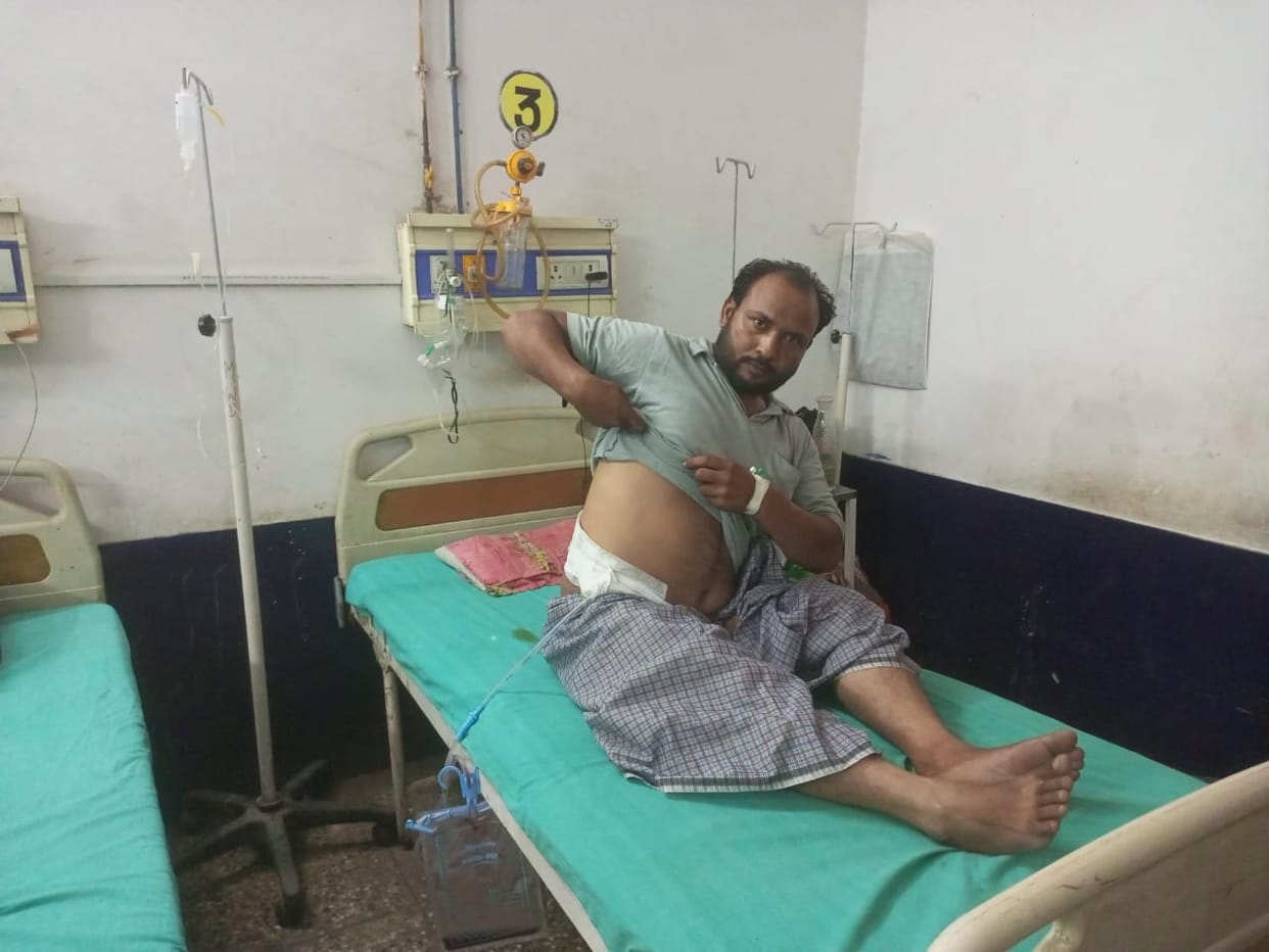 Stone did not come out even after operation, patient expressed pain