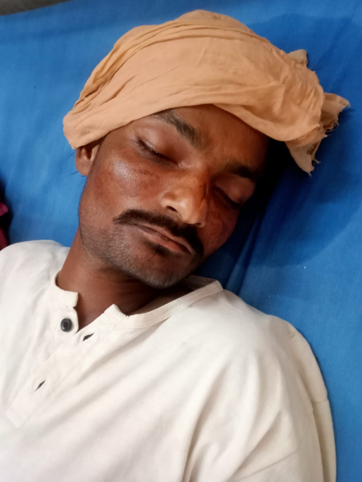 Young man affected by heat wave, admitted to medical college