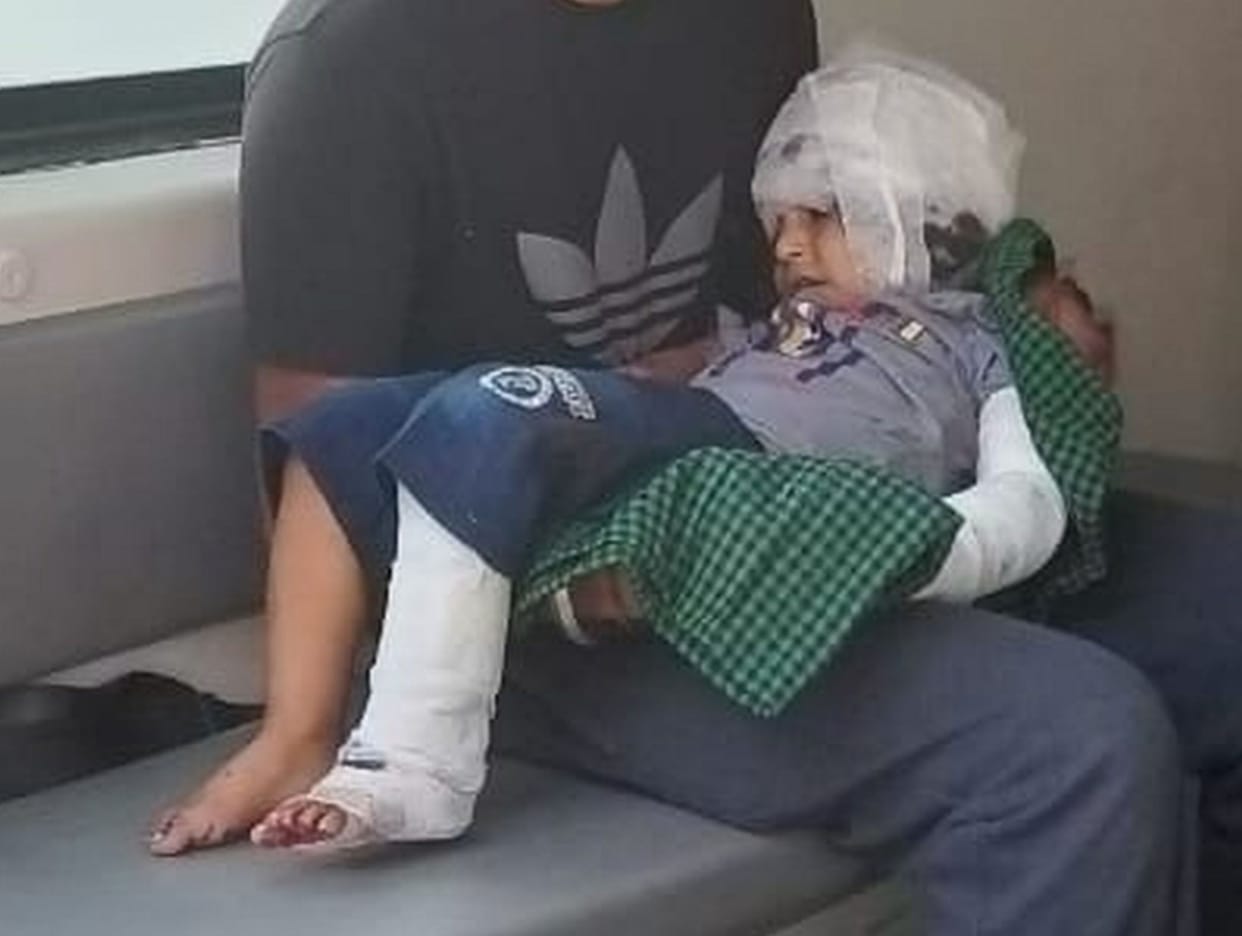 Injured child died during treatment