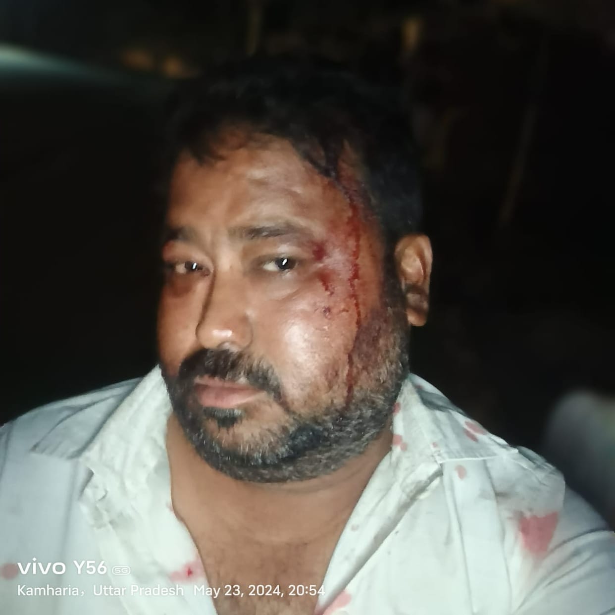 contractor attacked