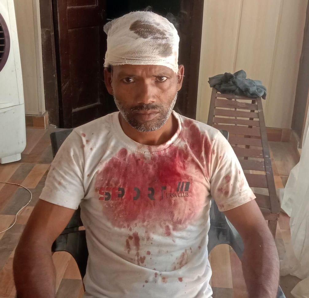 Younger brother attacked former councilor with a baton, injured