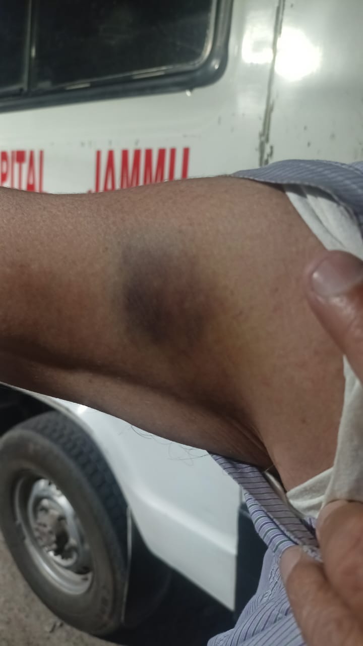 Fight in Family due to Cut the Electricity wire,