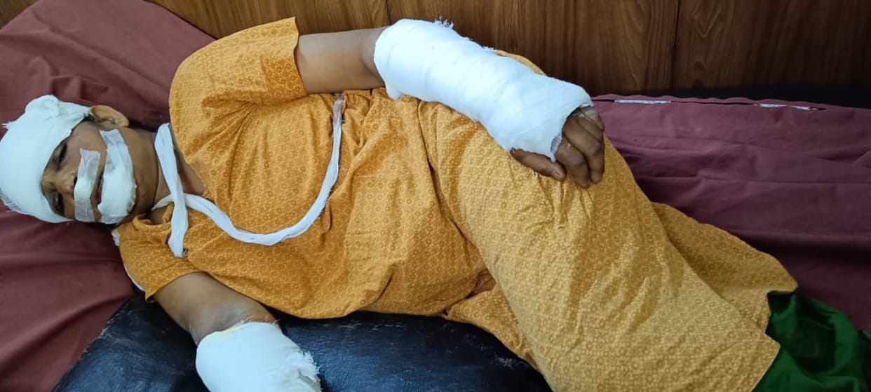 Woman fell from the roof after being threatened by monkeys, condition critical