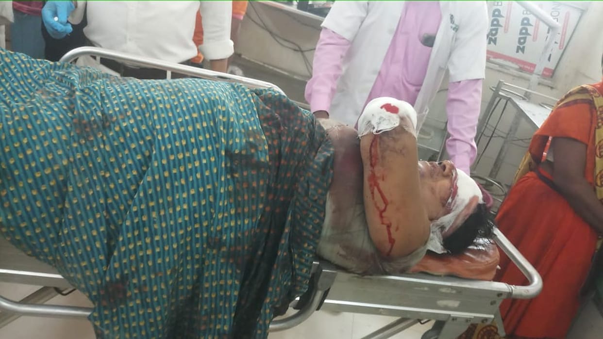 Mother-in-law and daughter-in-law attacked with a stick in family dispute