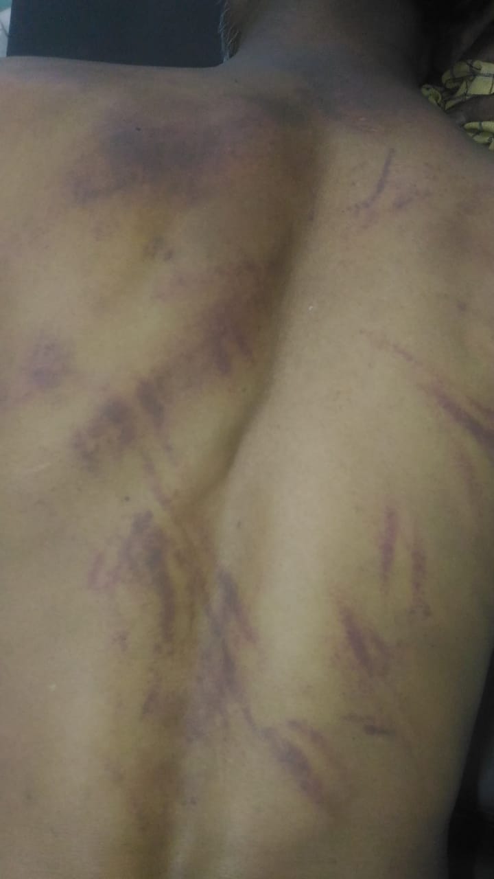 Young man kidnapped in Rohtak, tied to a tree and beaten, rubbed salt on the wound