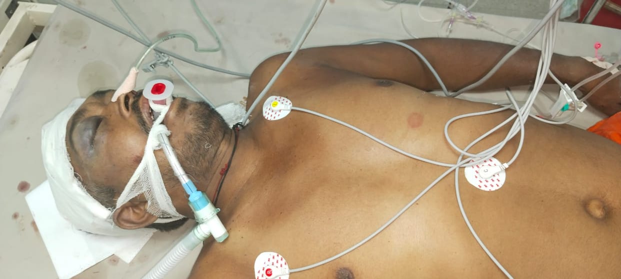 A deadly attack was made on two brothers who were cleaning the field
