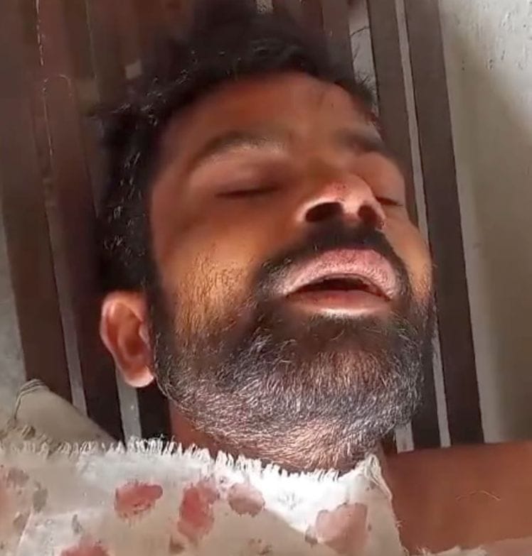 Family beaten for protesting against parking car in front of beauty parlor