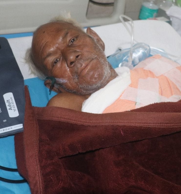 Worker's hand severed after being hit by legacy recycling machine