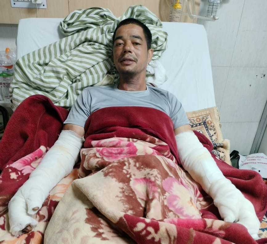 Demand for treatment of electrocuted employee
