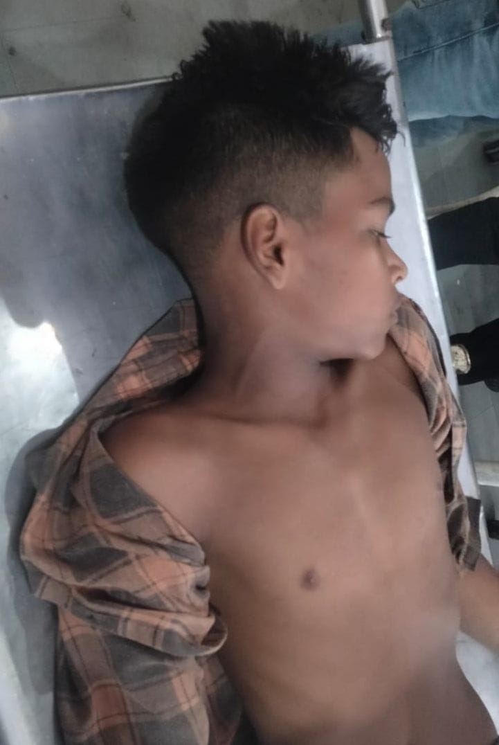 Teenager gets burnt after getting electrocuted
