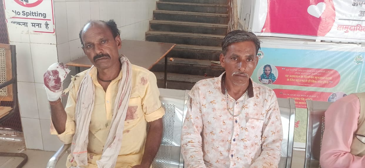 Damoh Derailed health services injured due to lightning and bus collision did not get ambulance facility
