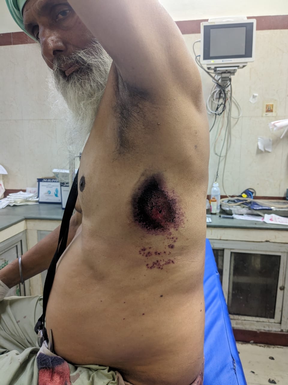 The thief shot two bullets, despite being injured the farmer caught one
