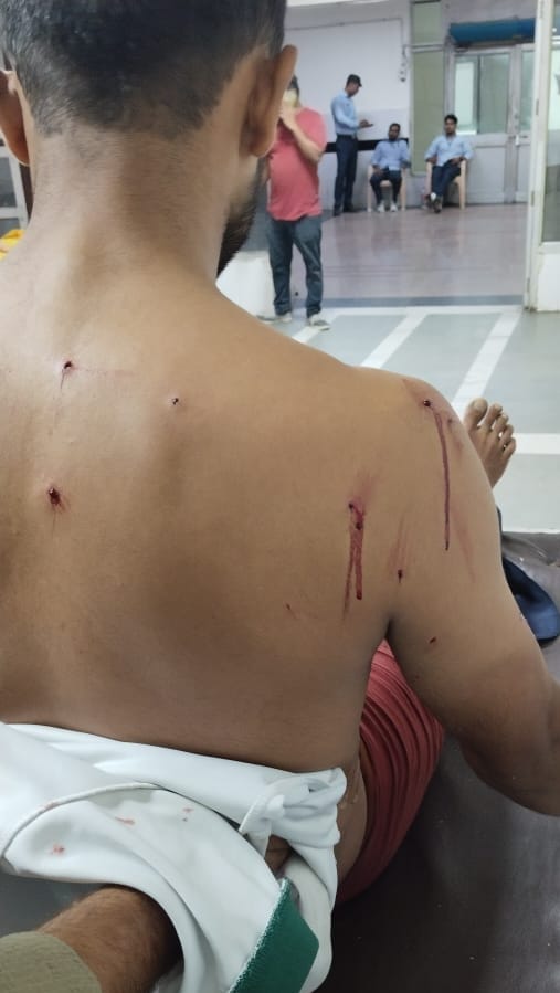 Cancer victim and her husband assaulted for picking berries that fell from the tree.